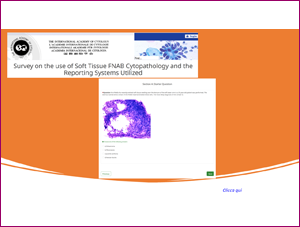 Survey on the use of Soft Tissue FNAB Cytopathology and the Reporting Systems Utilized

